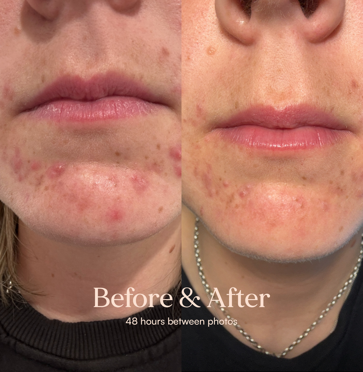 Hydrating Facial Mist - Serum in Mist – image 8