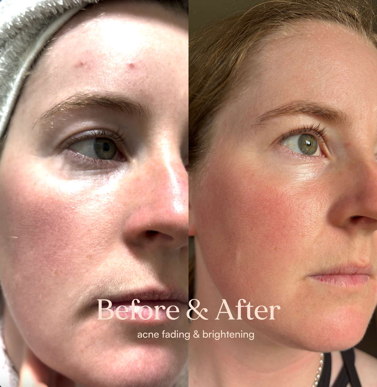 Hydrating Facial Mist - Serum in Mist – image 9